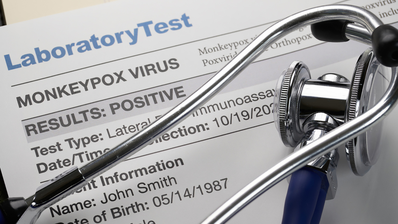 What is monkeypox and what is the risk?