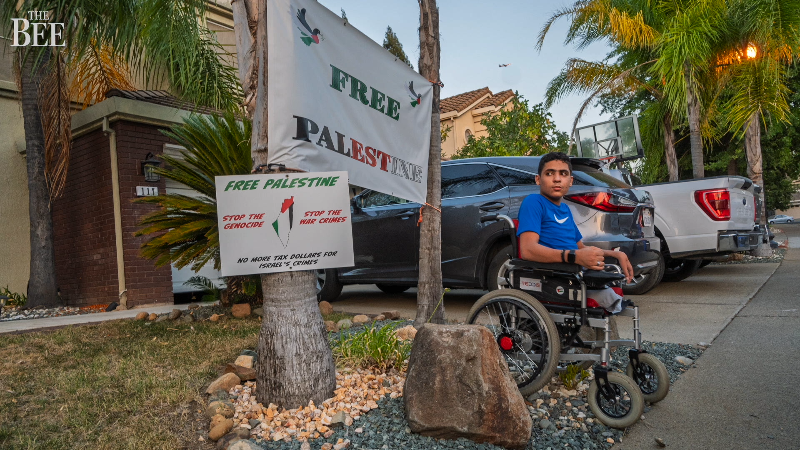 Gaza teen lives with uncertain future in Sacramento after losing legs in bombing