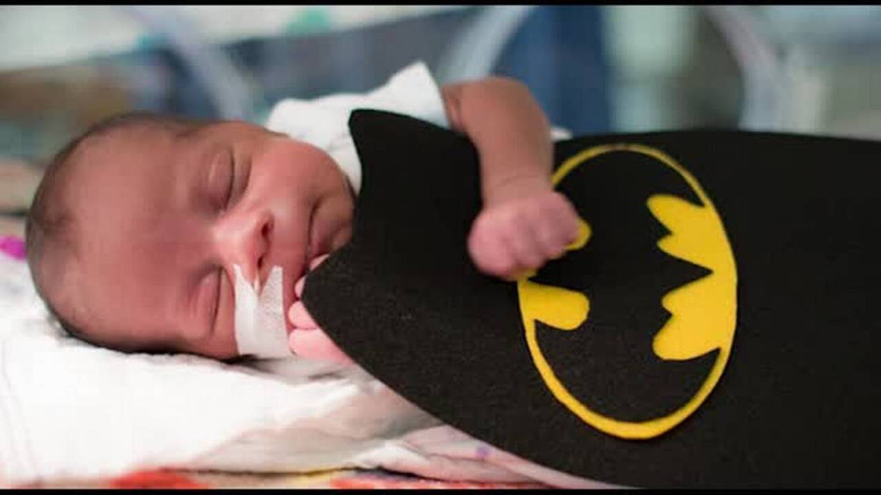 Adorable Halloween photos of newborns in neonatal care unit go viral