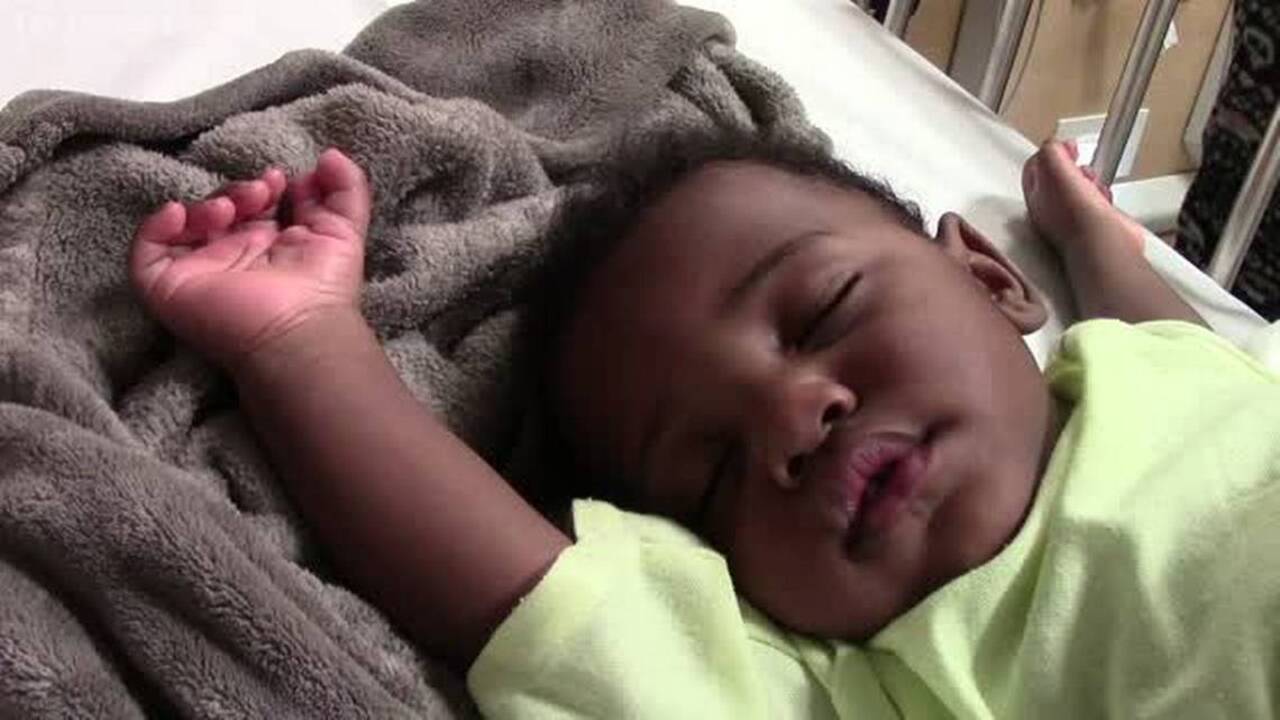 Inside the operating room: Reconstructive thumb surgery at Valley Children’s Hospital