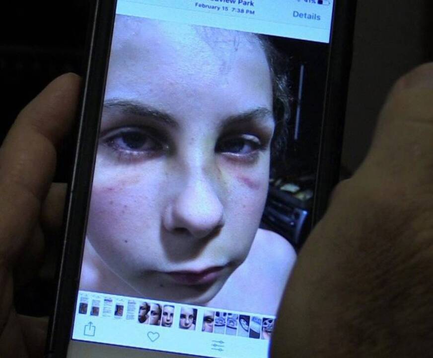 DJJ staffer body-slams, slugs a skinny 14-year-old
