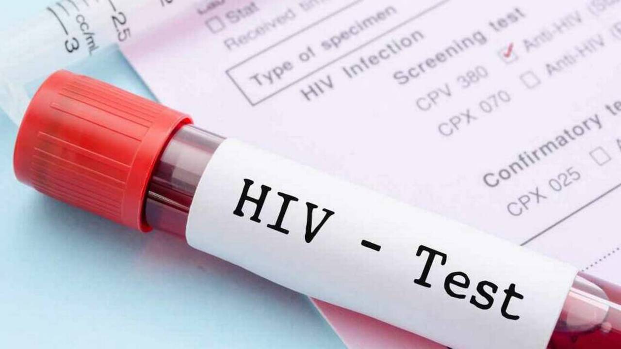 HIV and AIDS: The push to stop the virus