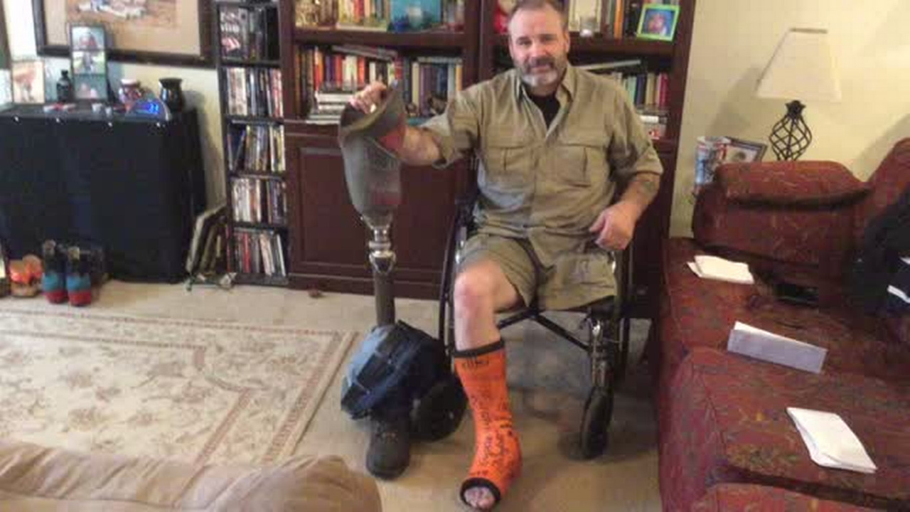 Rock Hill man who fixed things broke his only leg; now his friends hope to fix things