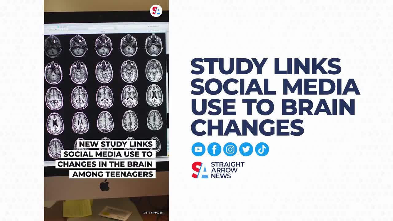 Being ‘chronically online’ may be changing teens’ brains