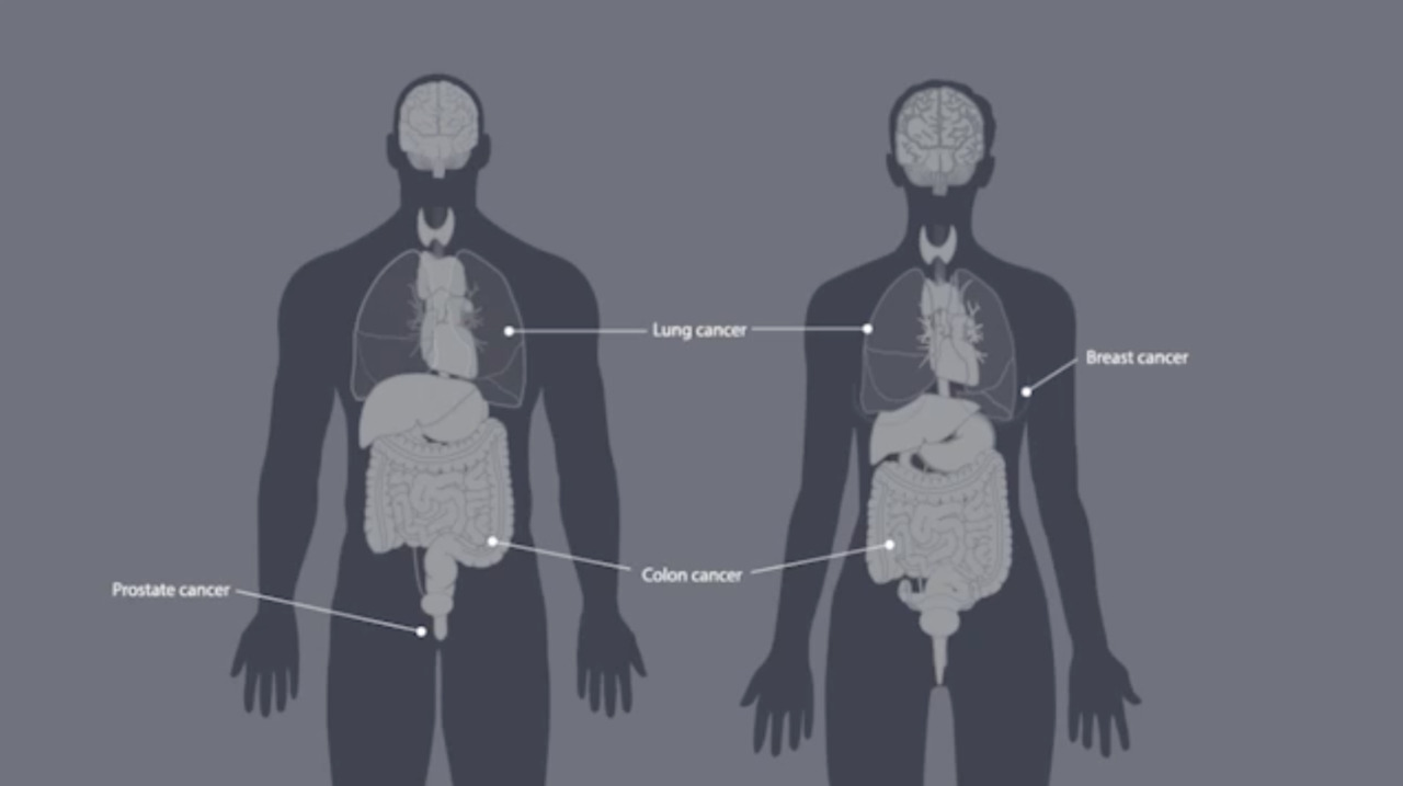 Understanding cancer