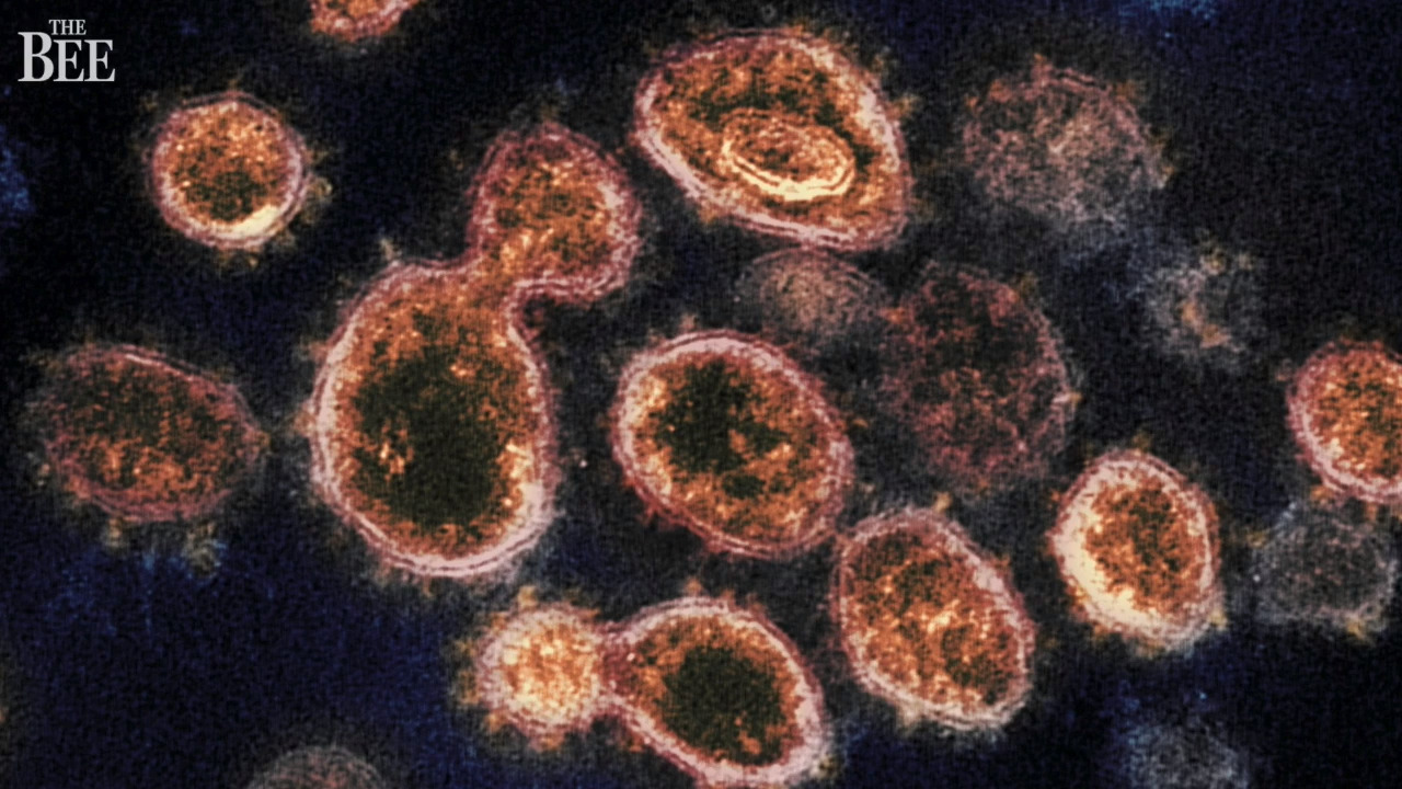 Here are the latest COVID-19 case numbers confirmed Friday in Washington state