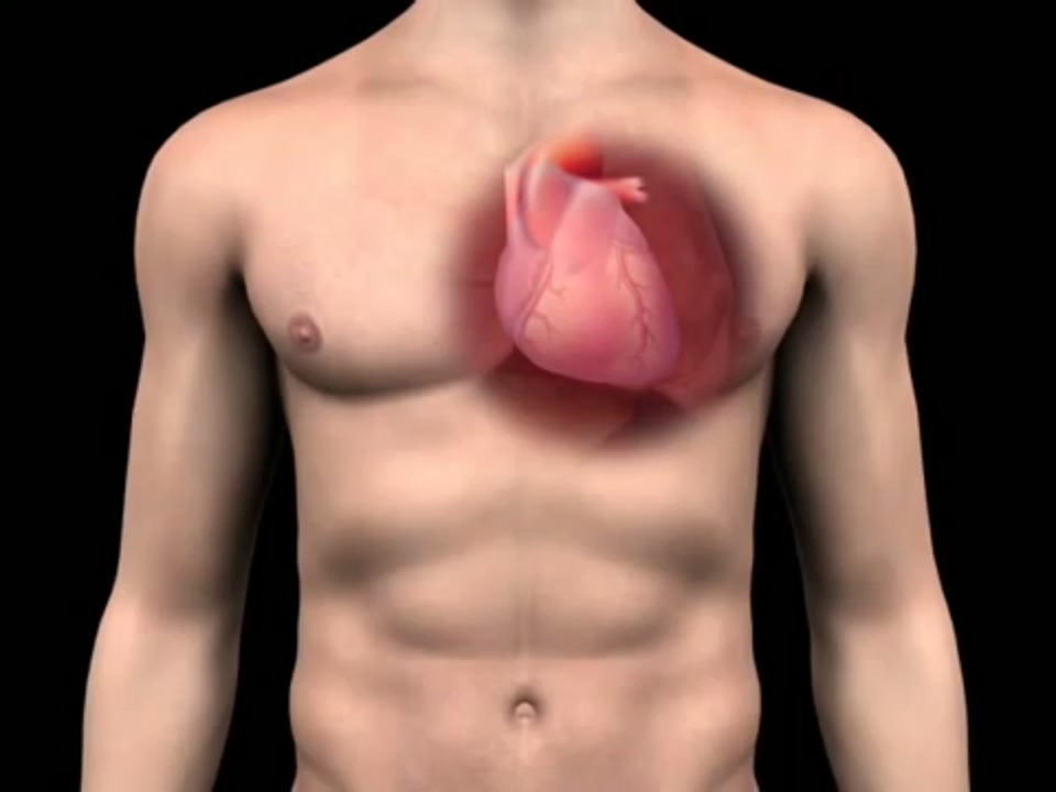 How to treat Pericarditis