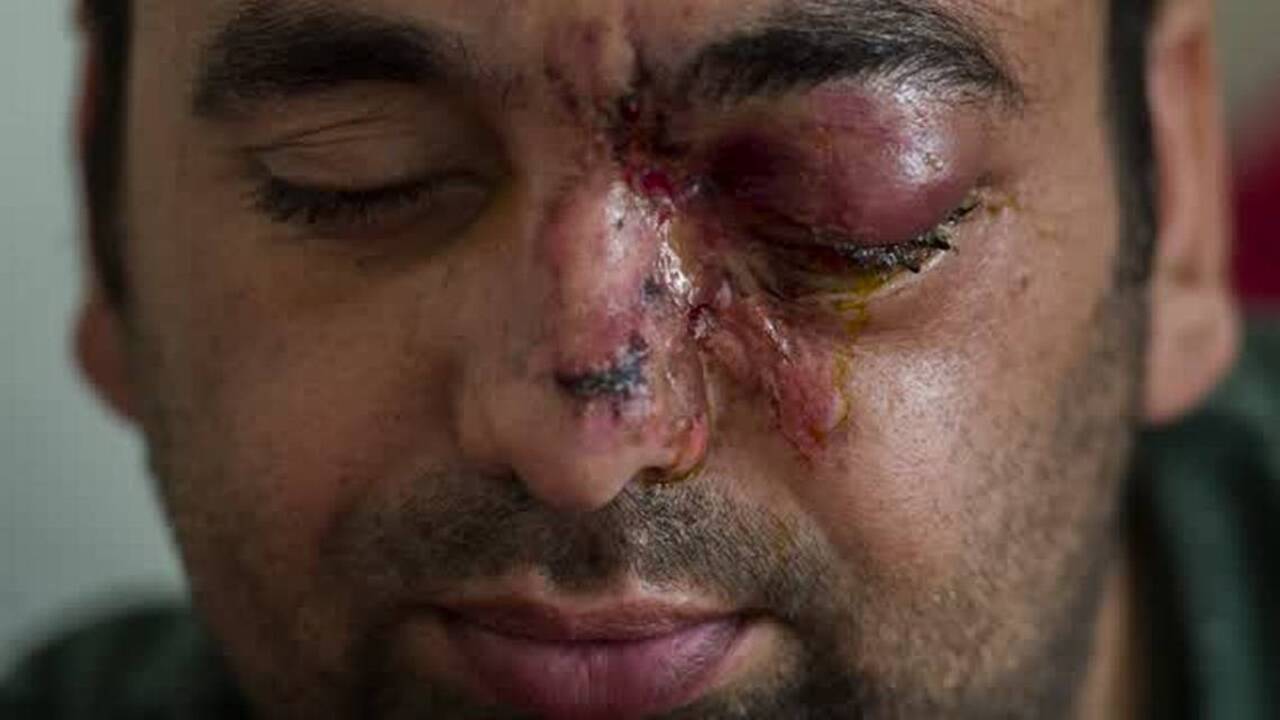 We owe Afghan refugees far better than this