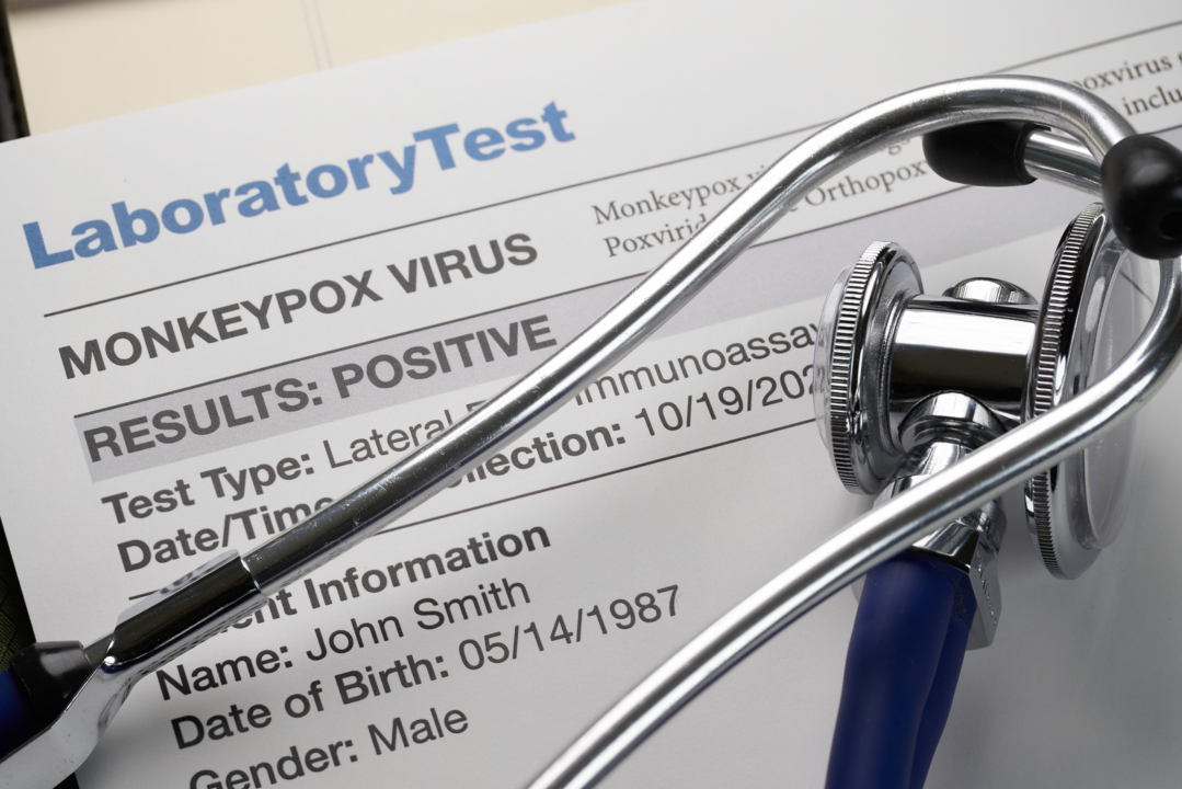 What is monkeypox and the risk?