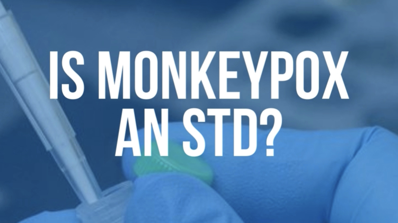 Fact check: Is monkeypox really an STD?