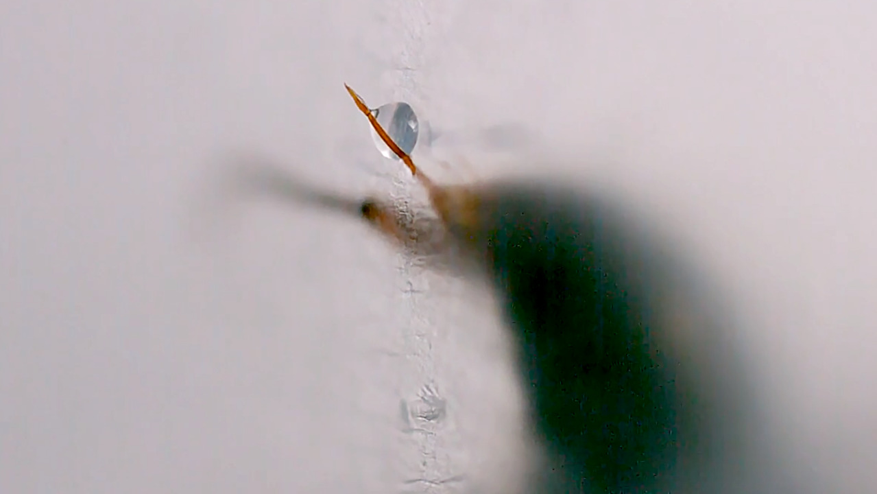 What happens when an ant stings you?