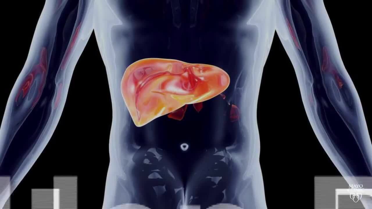 Dr. Wood: You might not know you have Hep C, which means you could be spreading it