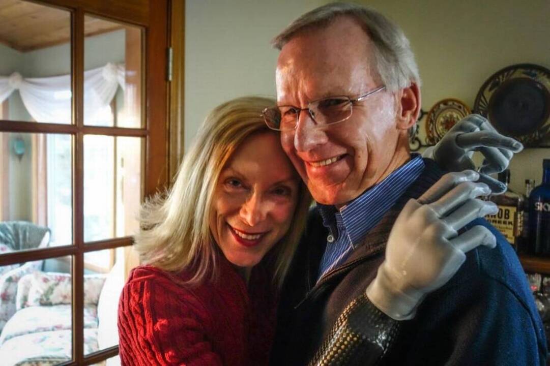 She needed new hands. Insurance wouldn't pay. He said, 'we're going to get them.'