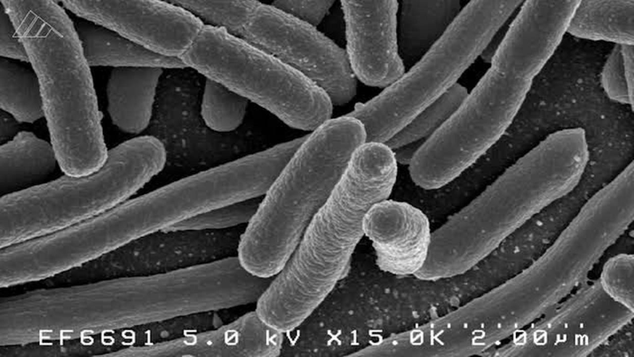 What you need to know about E. coli