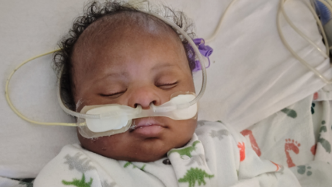 Tacoma infant undergoes bloodless open-heart surgery