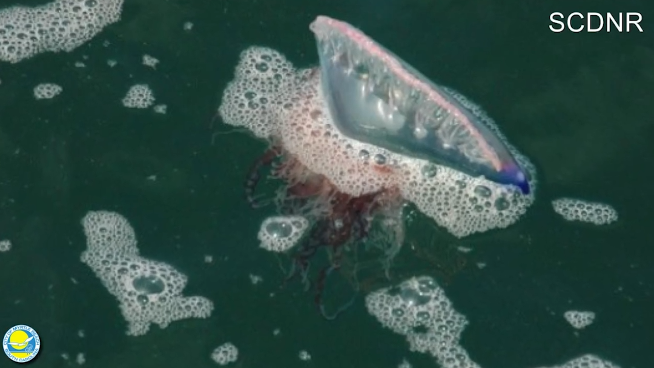 Stung by Portuguese Man O' War? What to do