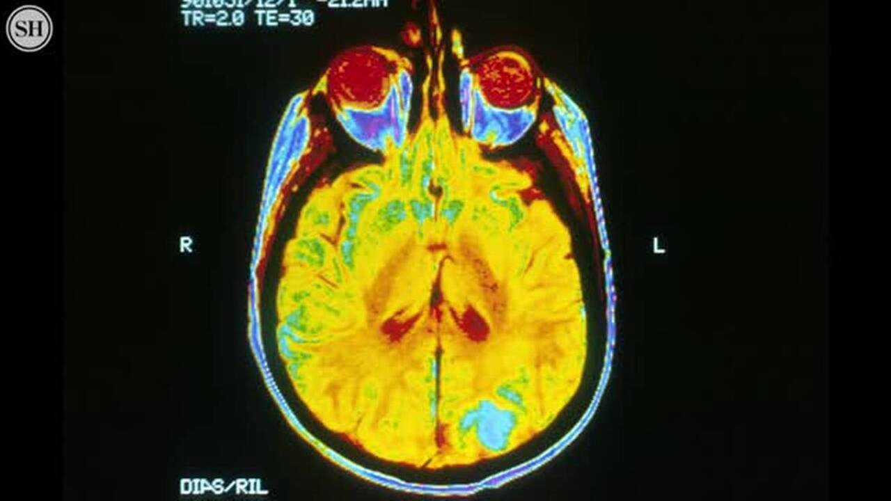 Mississippi investigated rare child cancer cases in Ocean Springs. Here’s what the report says.