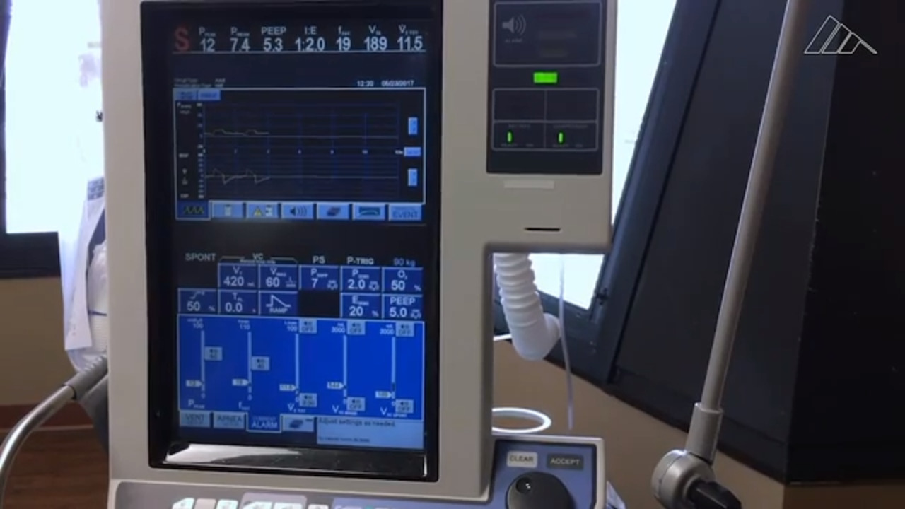 DNA test can diagnose COVID patients with pneumonia in hours—usual exam can take days