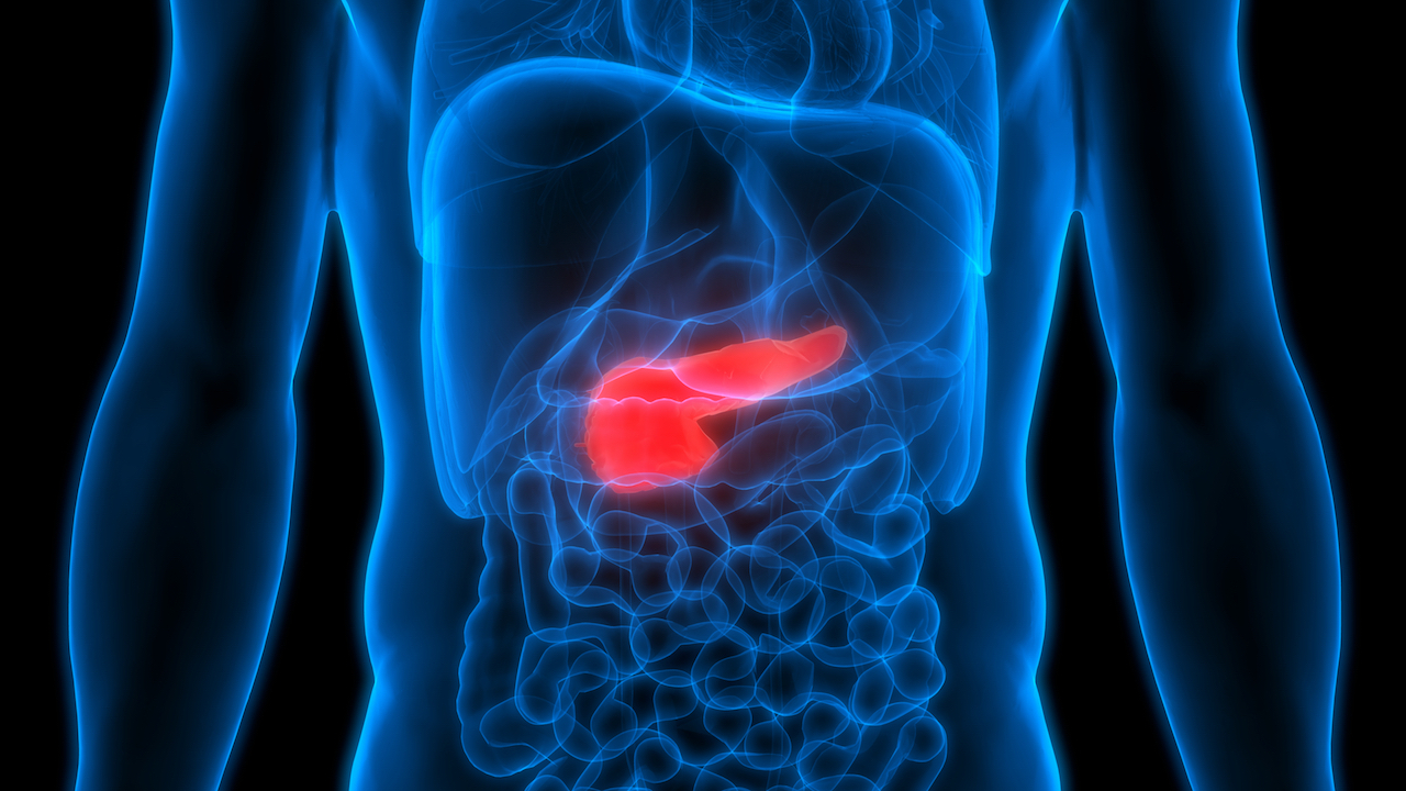 Signs and symptoms of pancreatic cancer can vary