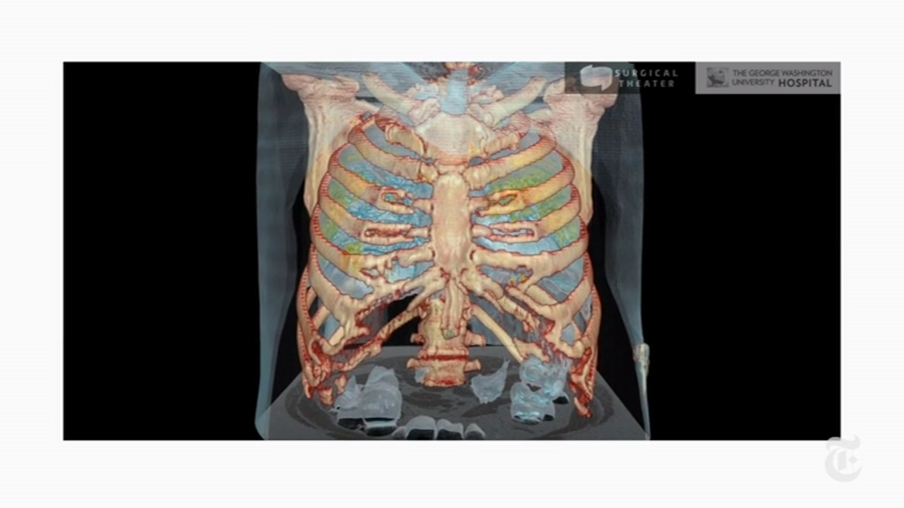 Don’t minimize the long-term effects of COVID-19 on younger people | Letter to the editor