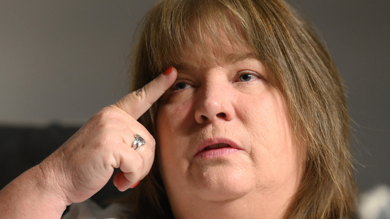 Rare eye condition causes Charlotte woman to lose sight