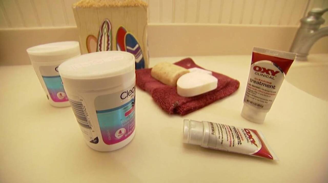 How to treat and prevent acne