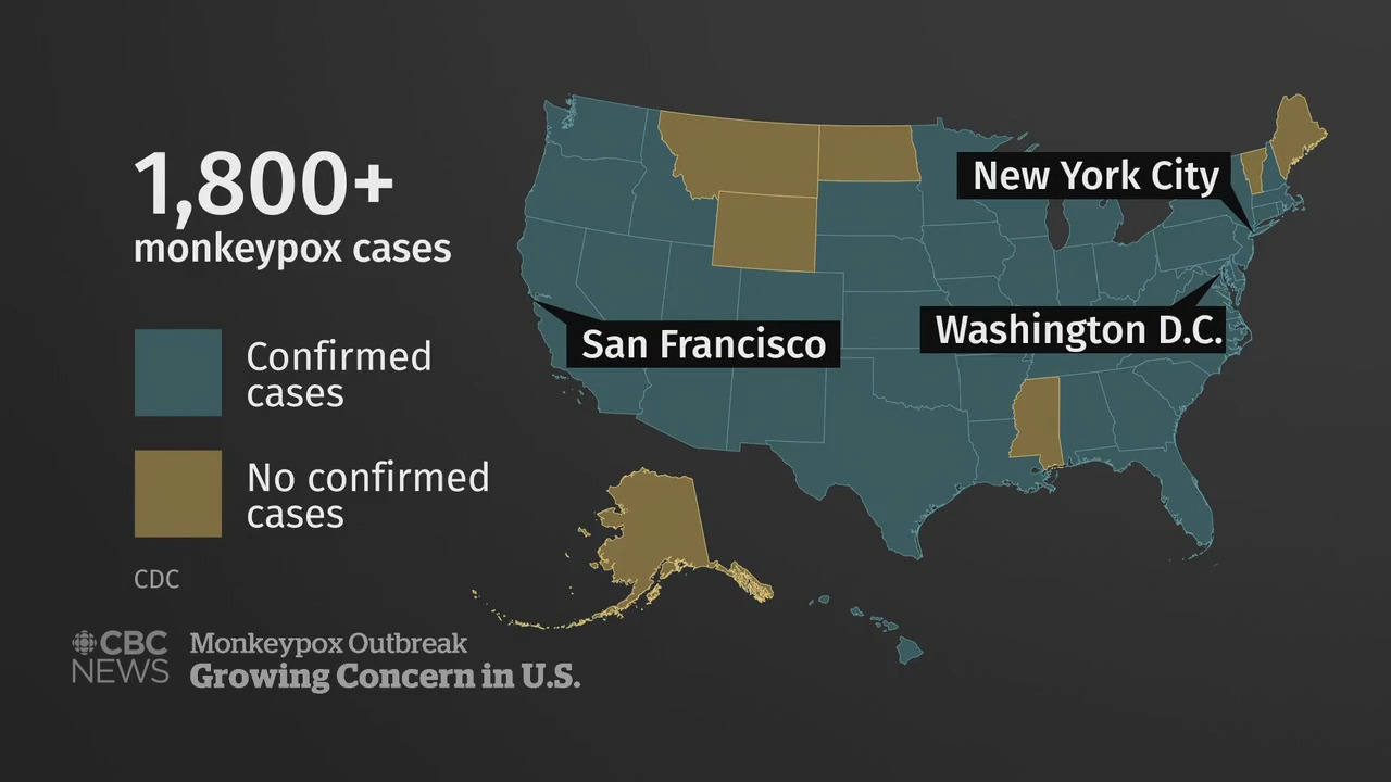 Mississippi confirms more monkeypox cases. What to know