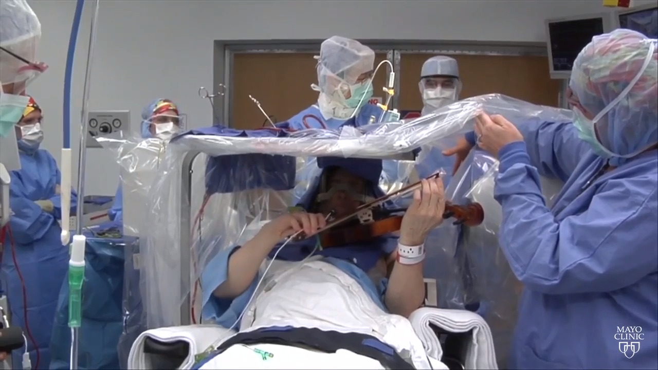Awake brain surgery can be good for you and your surgeon