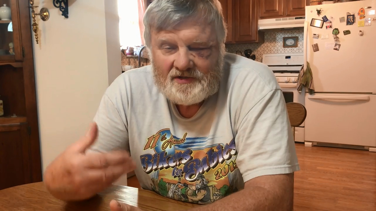 Food pantry director loses his eye, but not his perspective on caring