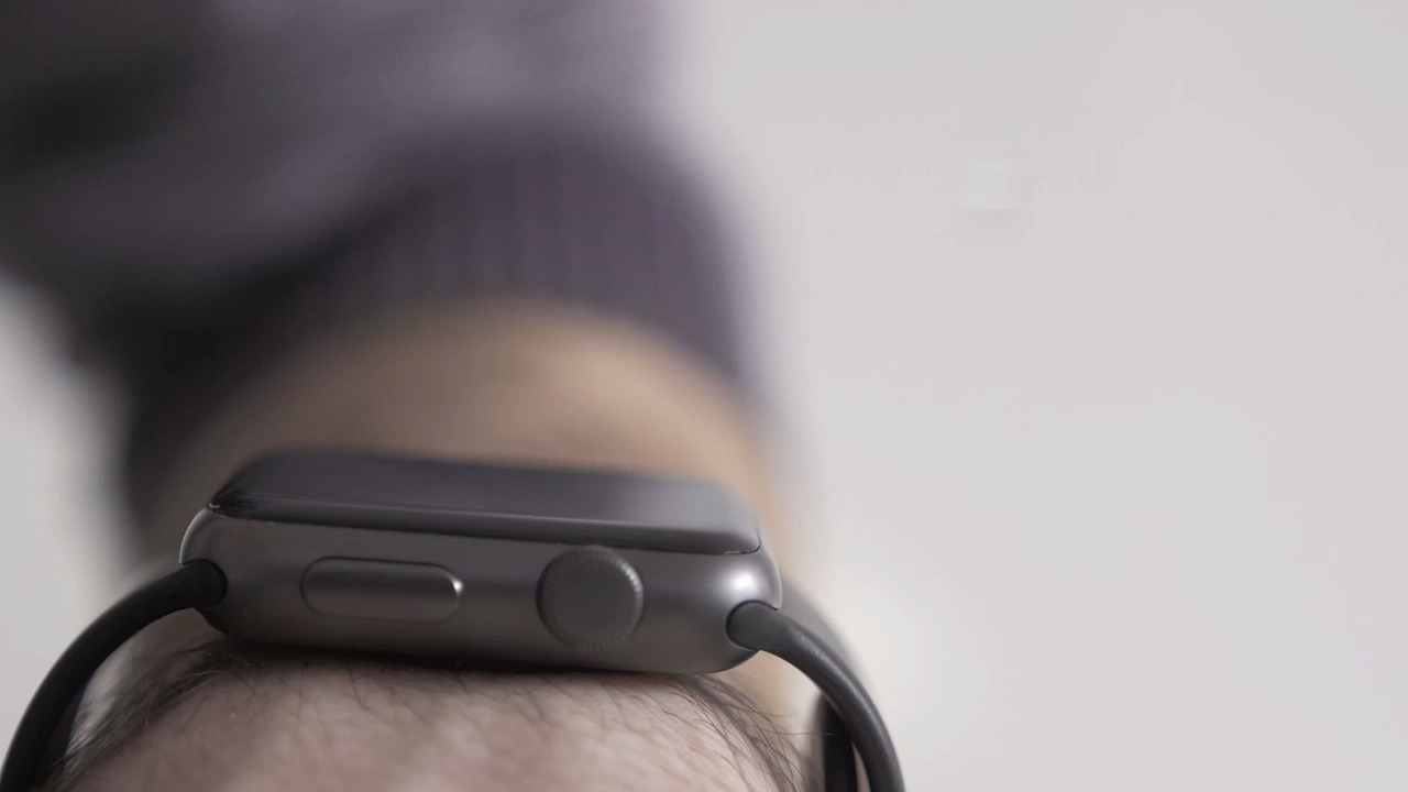 Nurses call this Kansas woman 'The Apple Watch Patient.' It may have saved her life