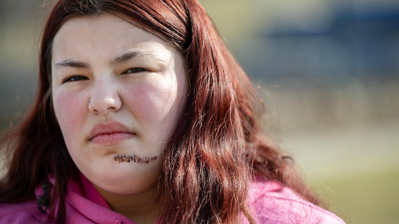 ‘Guardian angel:’ Bullet grazed teen’s chin, hit shoulder in Kansas City mass shooting