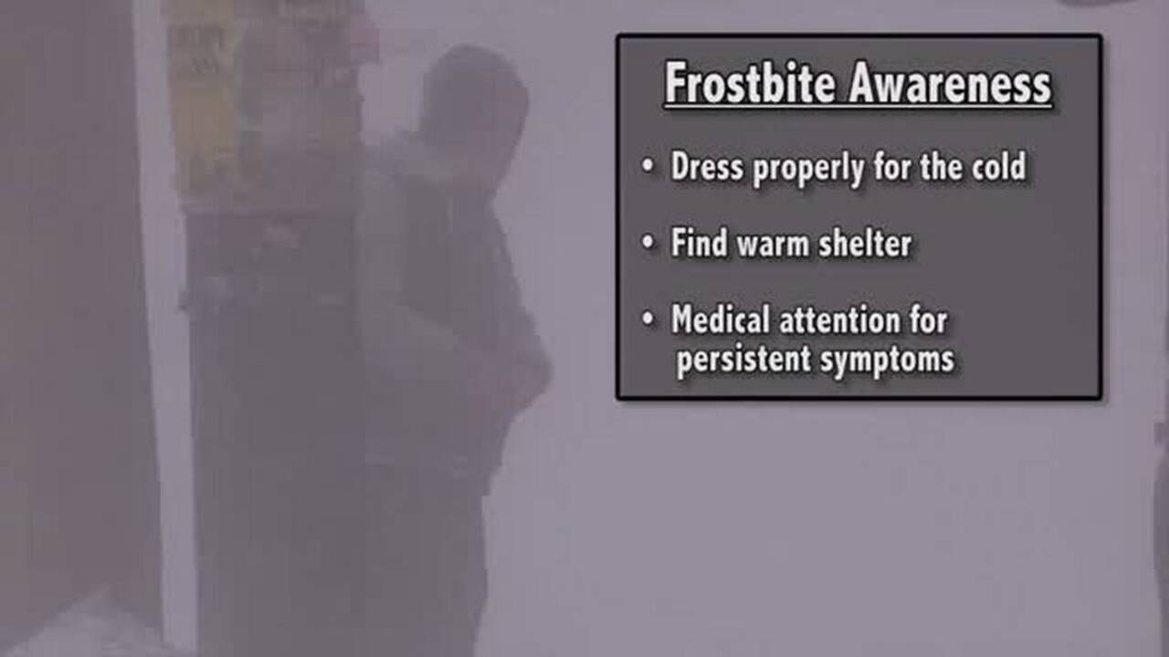 Frostbite and how to prevent it