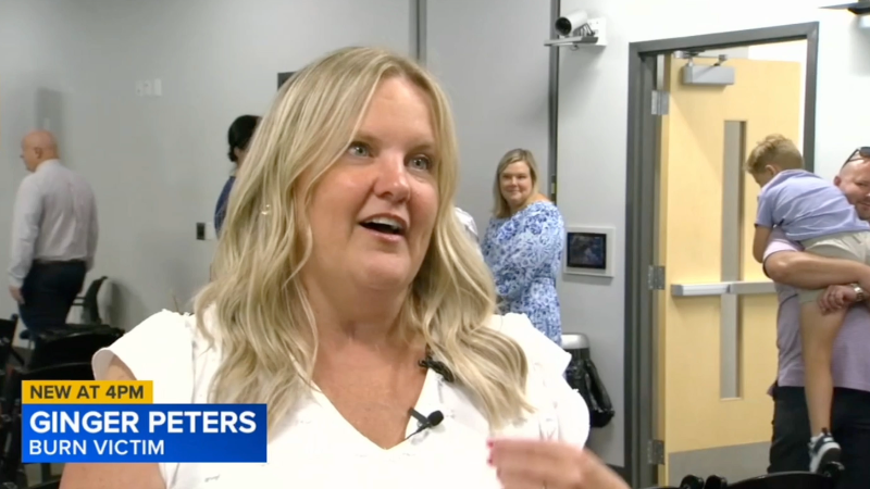Sparklers are dangerous; one woman shares her story