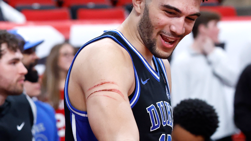 Duke's Cam Boozer on that scratch in victory over NC State: 'The Wolfpack got me'