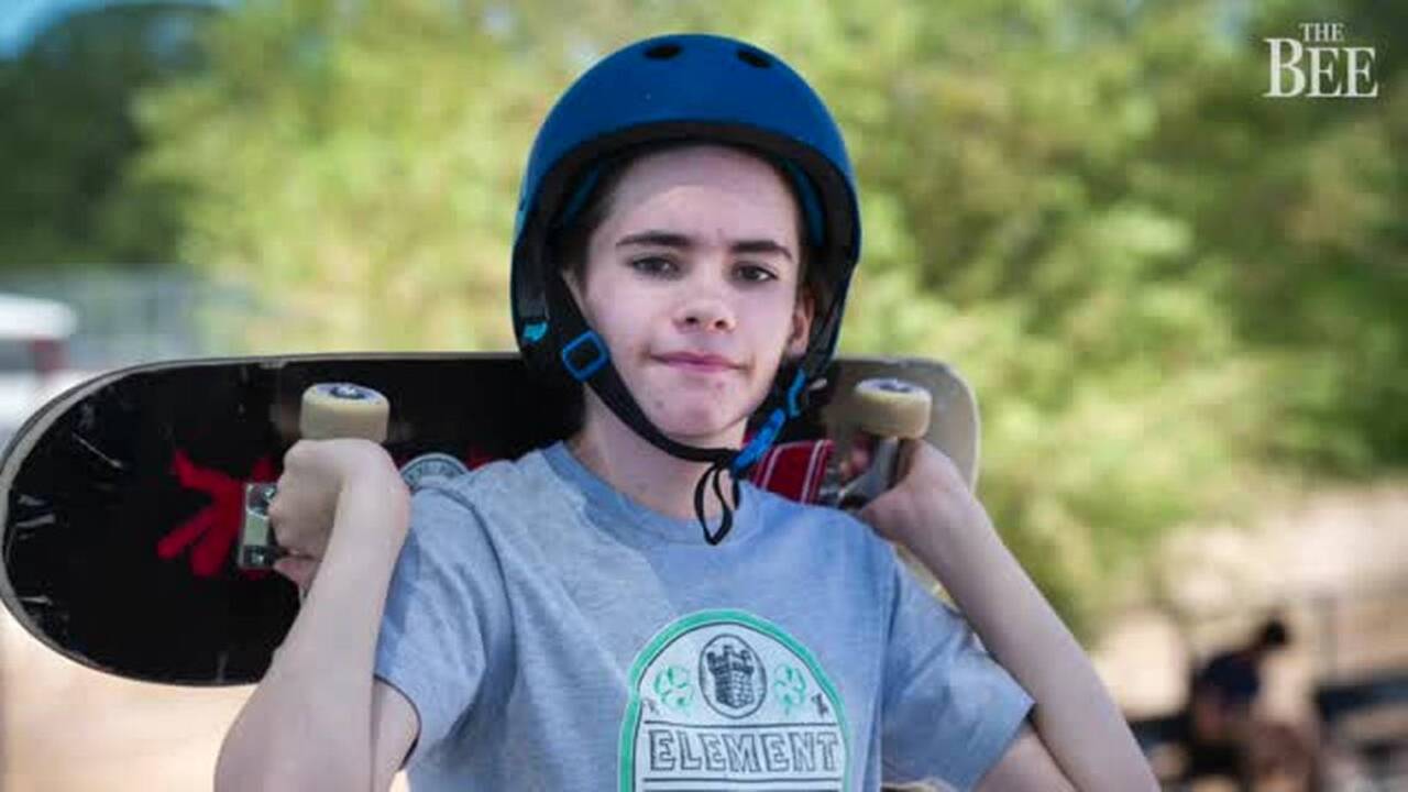 SkateMD skateboard therapy program helps autistic teen