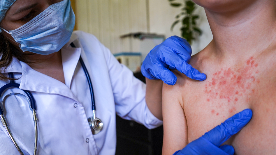 ‘It scares me’: Amid SC measles outbreak, one mother won’t leave the house