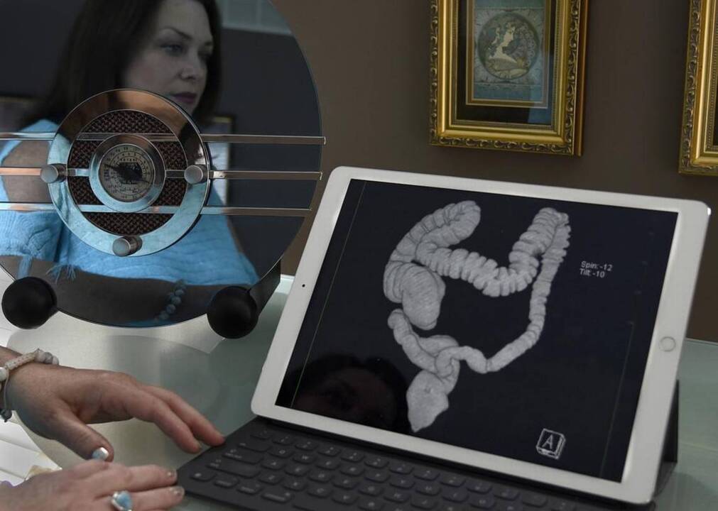What is a virtual colonoscopy?
