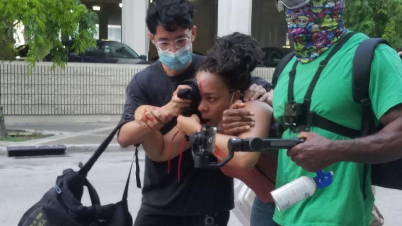 Fort Lauderdale PD investigating officer who shot woman in face with a rubber bullet