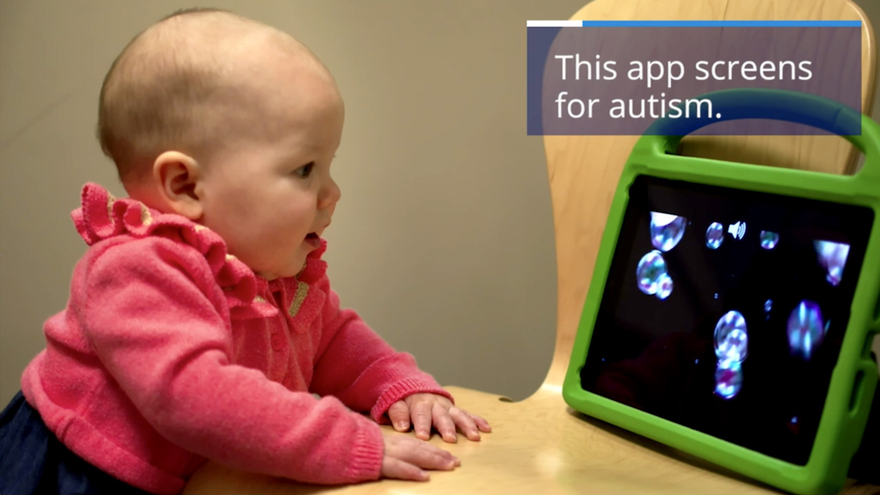 Duke team develops app to screen for autism in children