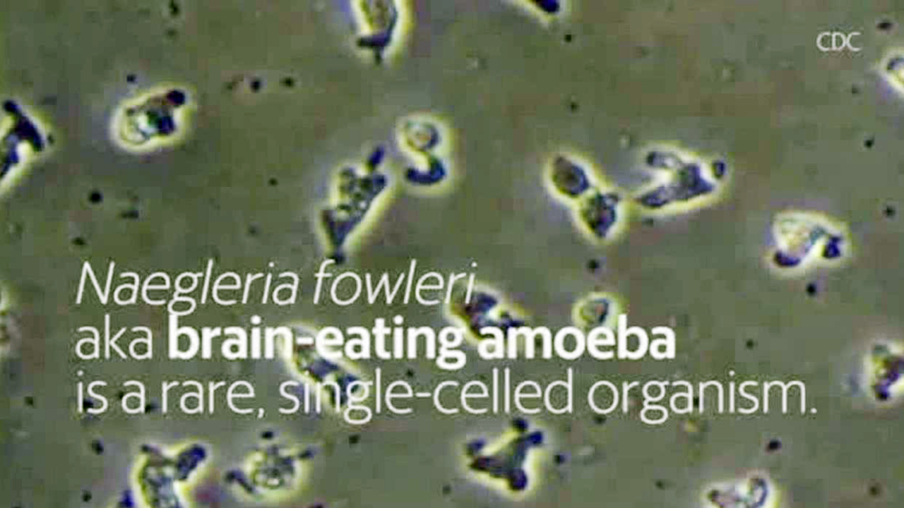 Brain-eating amoeba: What you need to know