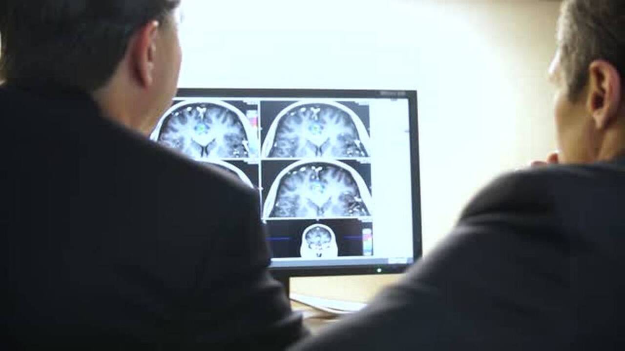Charlotte doctors find less radiation best for treating certain brain cancers
