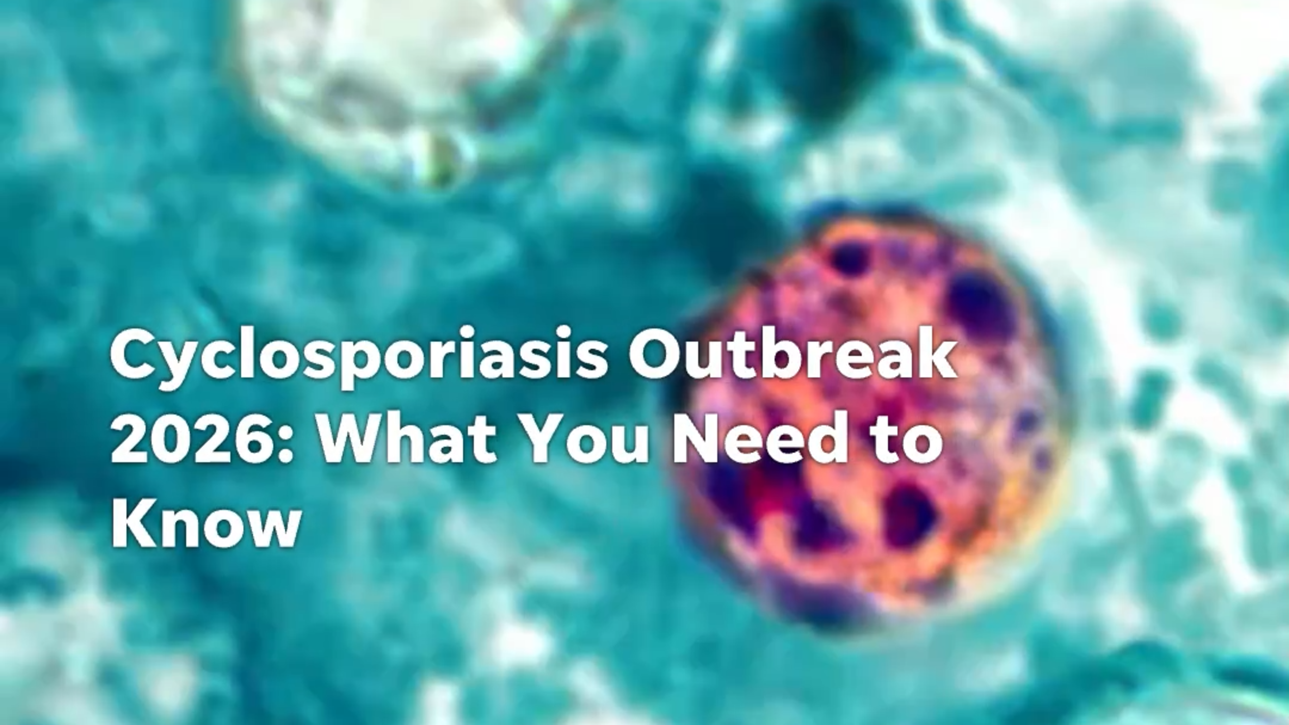 What is Cyclosporiasis? Symptoms, treatment, and prevention