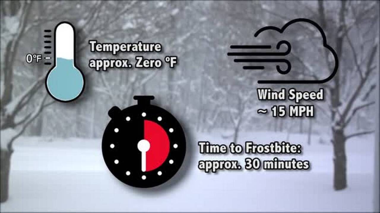 Frostbite and how to prevent it