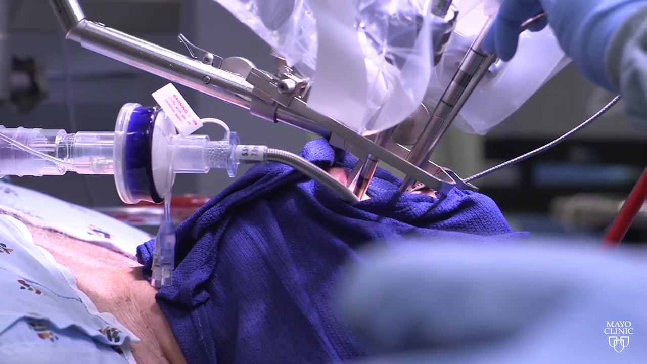 Could a vaccination prevent throat cancer?