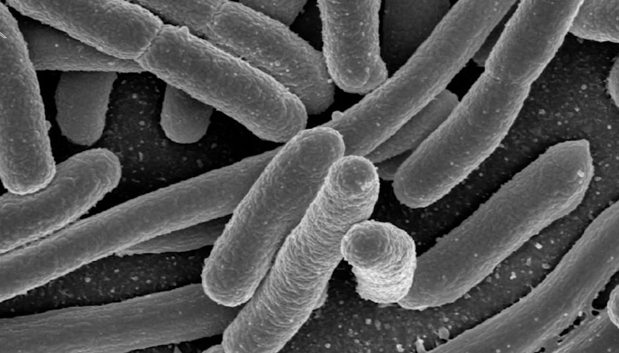 Here’s what you need to know about E. coli