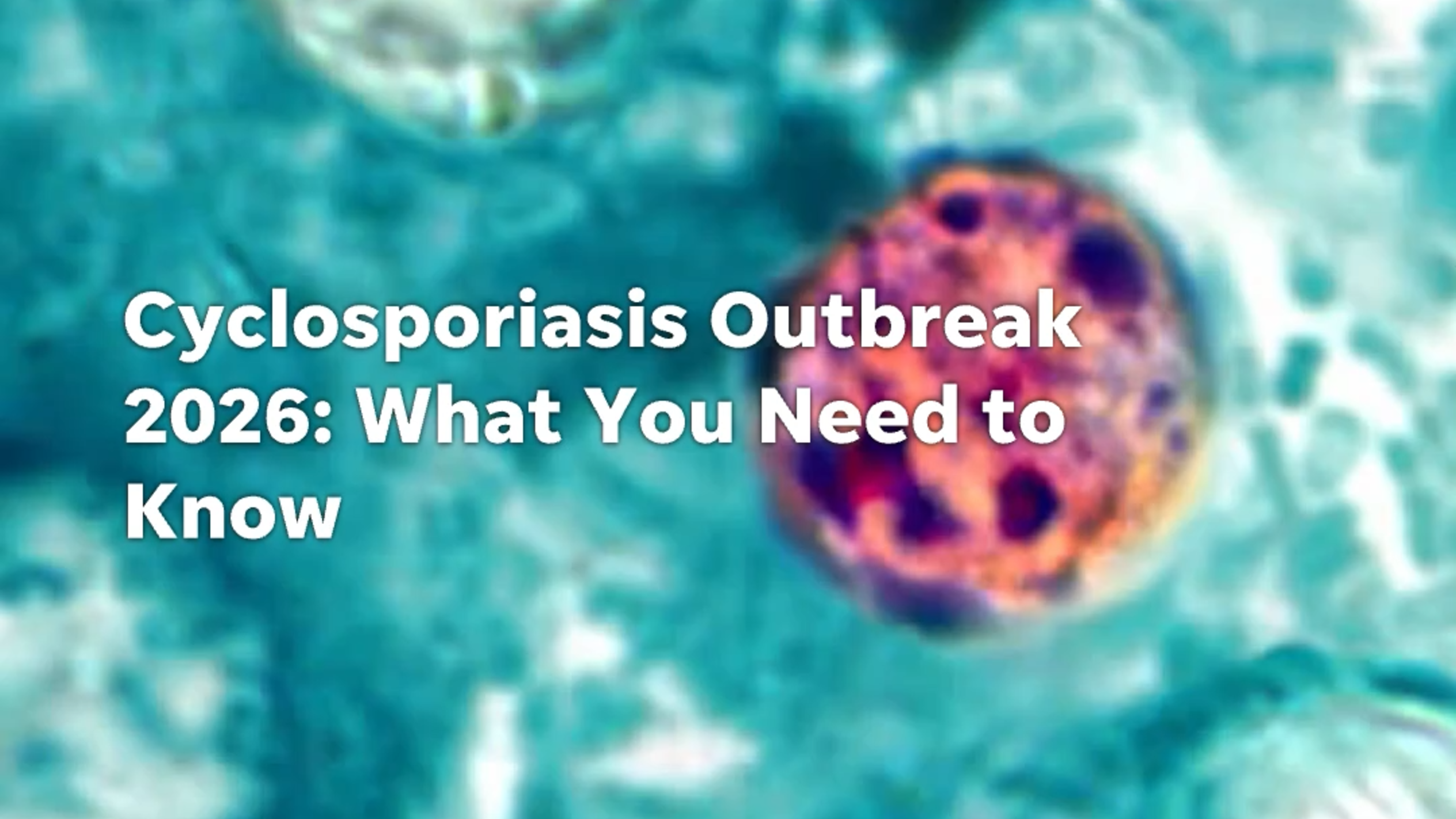 What is Cyclosporiasis? Symptoms, treatment, and prevention
