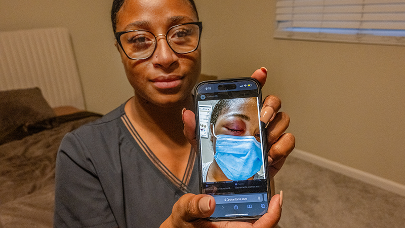 Officer blinded woman in one eye during protest. Here’s how much Sacramento paid her