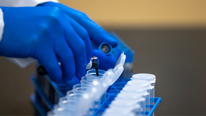 Kentucky researchers work on biomarkers to screen racehorses