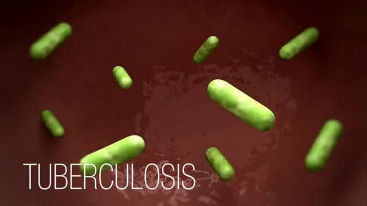 How does tuberculosis (TB) spread?