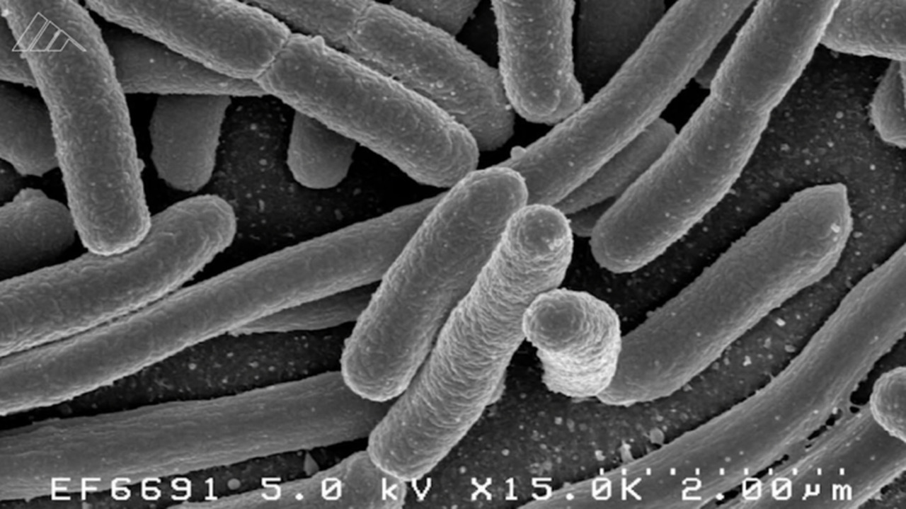 Your burger joint’s beef might be among 167,000 pounds recalled on E. coli concerns